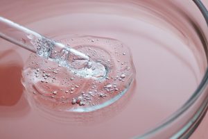 close-up-hyaluronic-acid-tratment close-up-hyaluronic-acid-tratment
